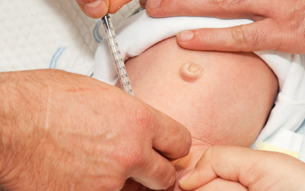 فواید ختنه نوزادان