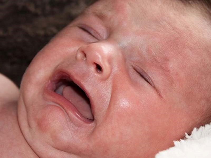 راهکار تشخیص آلرژی در نوزادان