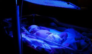 عوامل زردی نوزادان و درمان زردی،کلینیک کودکان آنا