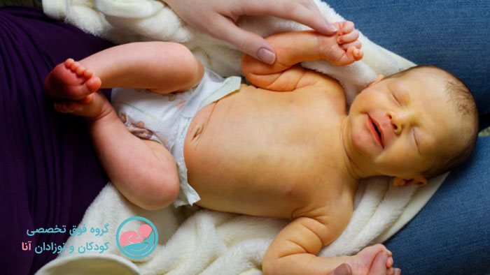 علائم زردی نوزاد
