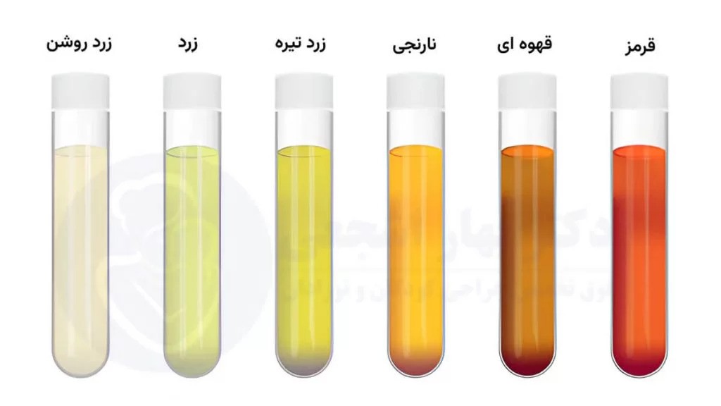 علت تغییر رنگ در ادرار کودکان