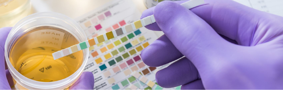 علت تغییر رنگ در ادرار کودکان