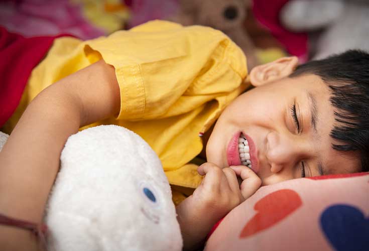 دندان قروچه در کودکان - دندان قروچه کودکان