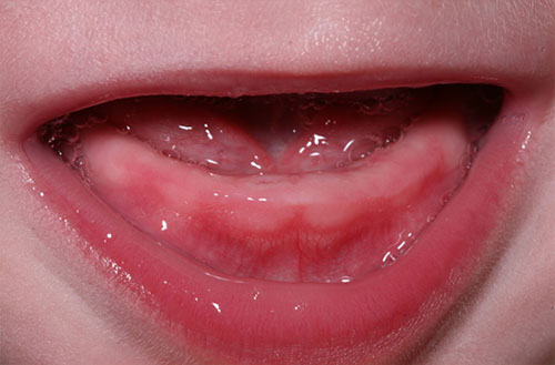 عکس دندان در آوردن نوزاد