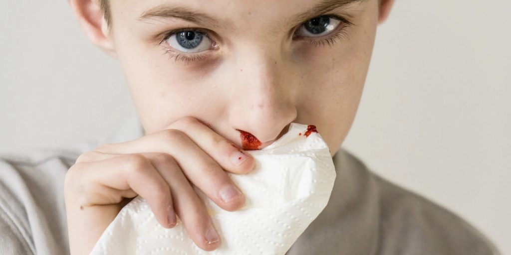 خون دماغ شدن کودک