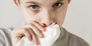 خون دماغ شدن کودک