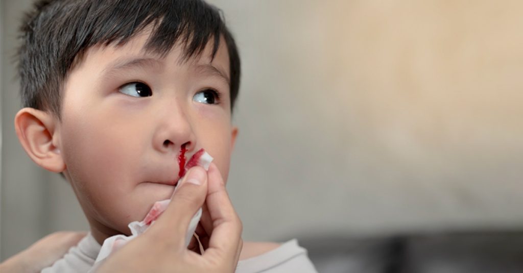 خون دماغ شدن کودک