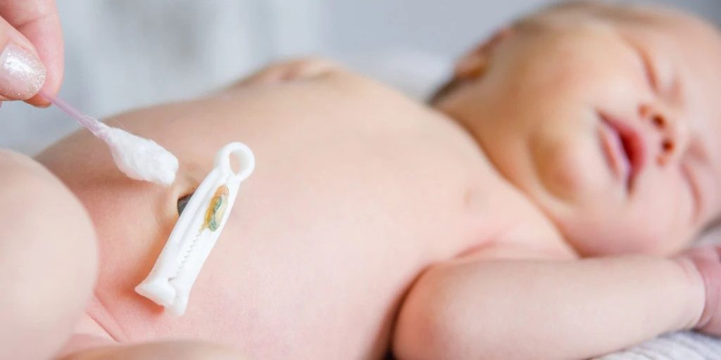 آموزش کامل مراقبت از بند ناف نوزاد