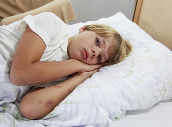 دلیل کبودی بی‌ دلیل بدن کودک