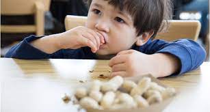 دلایل حساسیت به بادام‌زمینی در کودکان